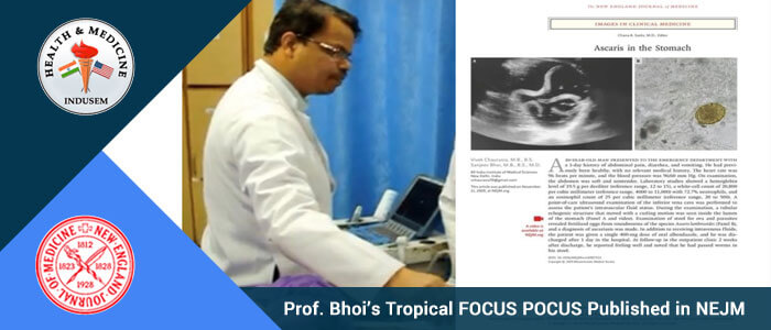 Prof. Bhoi’s Tropical FOCUS POCUS Published in NEJM